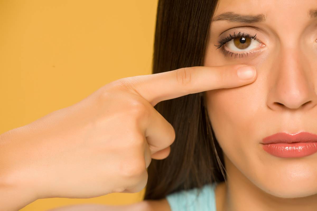 featured image for what causes fat deposits below the eyes